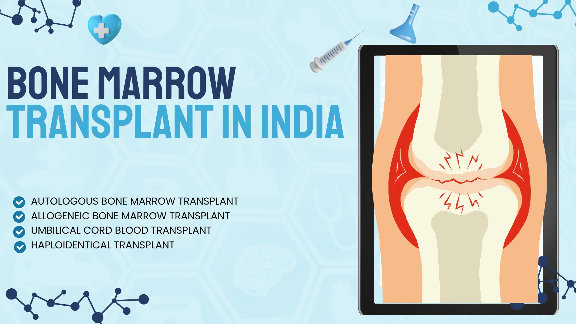 Bone Marrow Transplant in India